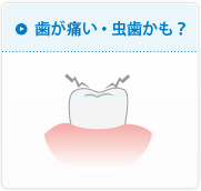 歯が痛い・虫歯かも