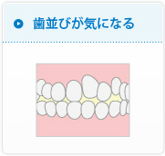 歯並びが気になる