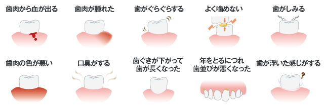 こんな症状があると歯周病の疑いがあります